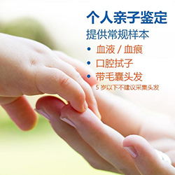 攀枝花隐私DNA亲子鉴定准确吗，攀枝花隐私亲子鉴定结果需要多久
