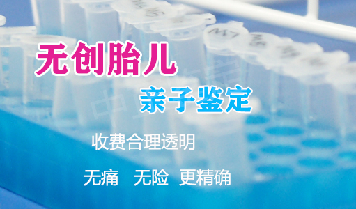 怀孕了攀枝花需要如何做产前亲子鉴定,攀枝花做孕期亲子鉴定结果准确吗